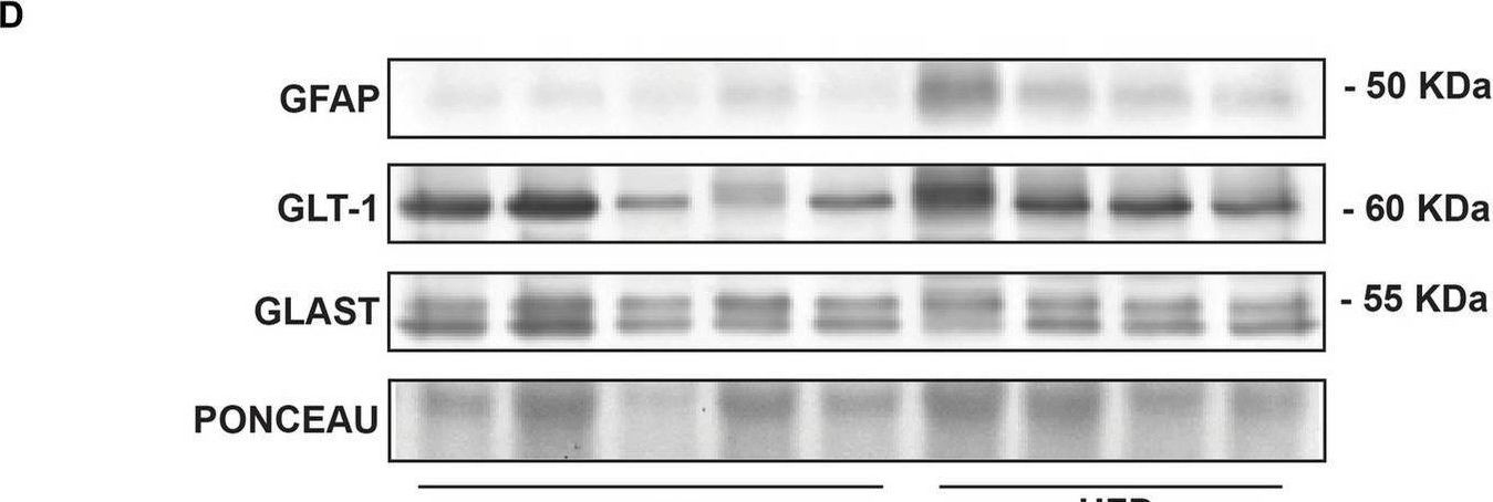 Fig.2.D showing Western Blotting in a Mus musculus (House mouse) sample from the publication: Impaired astrocytic synaptic function by peripheral cholesterol metabolite 27-hydroxycholesterol.