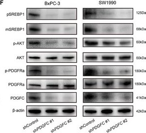 Fig.5.F showing Western Blotting from the publication: Platelet-Derived Growth Factor C Facilitates Malignant Behavior of Pancreatic Ductal Adenocarcinoma by Regulating SREBP1 Mediated Lipid Metabolism.