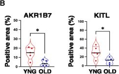 Fig.7.B showing Flow cytometry/Cell sorting from the publication: Reduced Akr1b7 signaling drives ovarian aging and reproductive dysfunction.