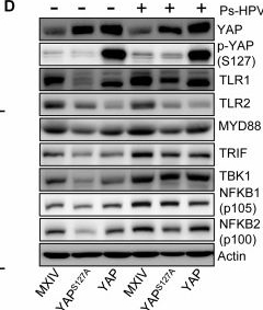 Fig.7.C showing Western Blotting from the publication: HPV-YAP1 oncogenic alliance drives malignant transformation of fallopian tube epithelial cells.
