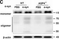 Fig.6.C showing Western Blotting in a Mus musculus (House mouse) sample from the publication: Blocking meningeal lymphatic drainage aggravates Parkinson's disease-like pathology in mice overexpressing mutated α-synuclein.