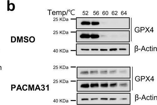Fig.7.B showing Western Blotting from the publication: The lipoprotein-associated phospholipase A2 inhibitor Darapladib sensitises cancer cells to ferroptosis by remodelling lipid metabolism.