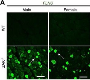 Fig.6.A showing Immunohistochemistry-immunofluorescence from the publication: Myofibrillar myopathy hallmarks associated with ZAK deficiency.