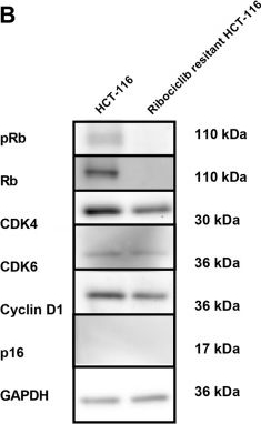 Fig.6.B showing Western Blotting in a Homo sapiens (Human) sample from the publication: Efficacy of CDK4/6 Inhibition in colorectal cancer and the role of p16 expression in predicting drug resistance.