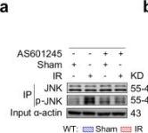 Phospho-SAPK/JNK (Thr183/Tyr185) (81E11) Rabbit Monoclonal