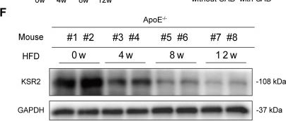 Fig.2.F showing Western Blotting from the publication: Endothelial KSR2 regulated by genetic variation protects against atherosclerosis through AMPKα1 stabilization.