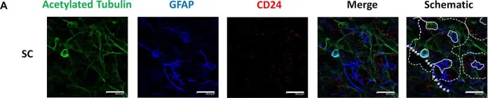 Fig.1.A showing Immunocytochemistry in a Mus musculus (House mouse) sample from the publication: Organized Neurogenic-Niche-Like Pinwheel Structures Discovered in Spinal Cord Tissue-Derived Neurospheres.