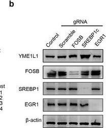 Fig.4.B showing Western Blotting from the publication: SREBP1c-Mediated Transcriptional Repression of YME1L1 Contributes to Acute Kidney Injury by Inducing Mitochondrial Dysfunction in Tubular Epithelial Cells.