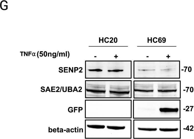 Fig.1.G showing Western Blotting in a HIV sample from the publication: Comprehensive SUMO Proteomic Analyses Identify HIV Latency-Associated Proteins in Microglia.