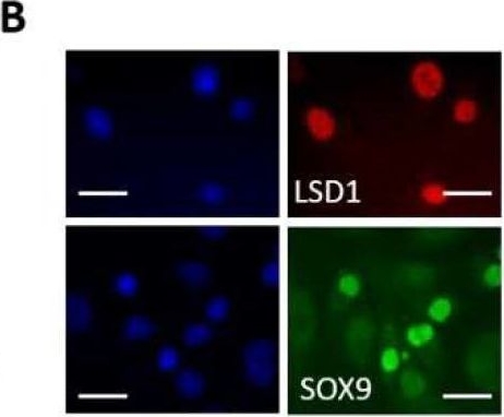 Fig.3.B showing Immunocytochemistry-immunofluorescence in a Homo sapiens (Human) sample from the publication: The Lysine Specific Demethylase-1 Negatively Regulates the COL9A1 Gene in Human Articular Chondrocytes.