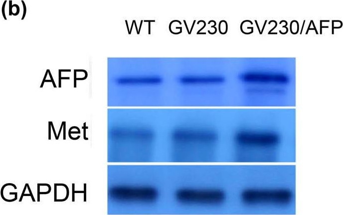 Fig.5.B showing Western Blotting in a Homo sapiens (Human) sample from the publication: α-Fetoprotein contributes to the malignant biological properties of AFP-producing gastric cancer.