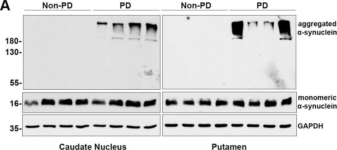 Fig.3.A showing Western Blotting in a Homo sapiens (Human) sample from the publication: Assessment of Aggregated and Exosome-Associated α-Synuclein in Brain Tissue and Cerebrospinal Fluid Using Specific Immunoassays.