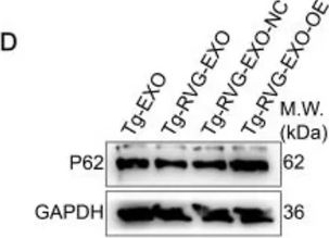 Fig.6.D showing Western Blotting in a Mus musculus (House mouse) sample from the publication: Therapeutic potential and underlying mechanisms of engineered young plasma-derived exosomes in Alzheimer's disease.
