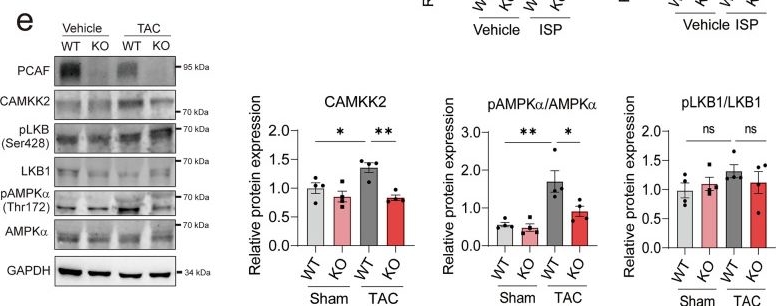 Fig.5.E showing Western Blotting from the publication: Loss of p300/CBP-associated factor aggravates cardiac remodeling via regulation of CAMKK2 acetylation.
