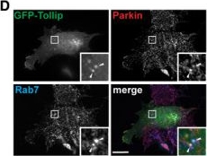 Fig.2.D showing Immunocytochemistry-immunofluorescence in a Homo sapiens (Human) sample from the publication: Tollip coordinates Parkin-dependent trafficking of mitochondrial-derived vesicles.