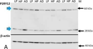 Fig.2.A showing Western Blotting in a Homo sapiens (Human) sample from the publication: Patterns of Expression of Purinergic Receptor P2RY12, a Putative Marker for Non-Activated Microglia, in Aged and Alzheimer's Disease Brains.