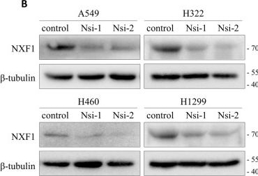 Fig.5.B showing Western Blotting in a Homo sapiens (Human) sample from the publication: Nucleoporin TPR promotes tRNA nuclear export and protein synthesis in lung cancer cells.