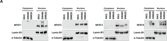 Fig.6.A showing Western Blotting from the publication: Non-canonical Wnt/Ca2+ signaling is essential to promote self-renewal and proliferation in colon cancer stem cells.