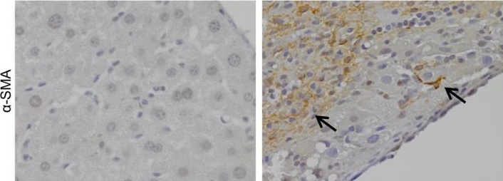 Local but not systemic administration of mesenchymal stromal cells ameliorates fibrogenesis in regenerating livers.