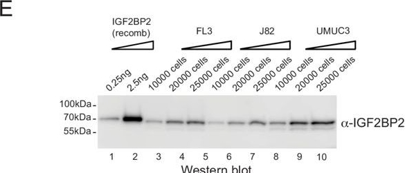Fig.6.E showing Western Blotting from the publication: circHIPK3 nucleates IGF2BP2 and functions as a competing endogenous RNA.