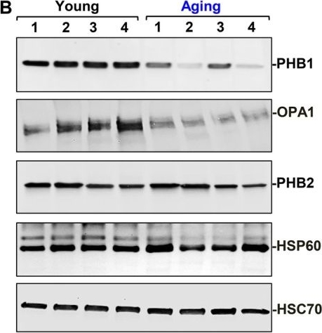 Fig.4.B showing Western Blotting in a Mus musculus (House mouse) sample from the publication: Age-Associated Impairment of Paneth Cells Driven by microRNA-152 Promotes Intestinal Epithelial Vulnerability to Pathological Stress.