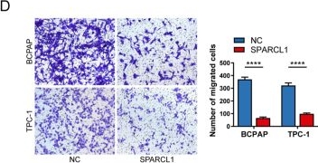 Fig.2.D showing Immunohistochemistry from the publication: The secreted protein SPARCL1 suppresses tumor progression in papillary thyroid carcinoma via SLC3A2-mediated ferroptosis.
