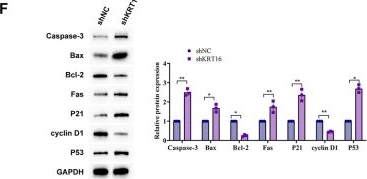 Fig.2.F showing Western Blotting in a Homo sapiens (Human) sample from the publication: KRT16 and APOA1: key regulators of proliferation and lipid metabolism in non-small cell lung cancer.