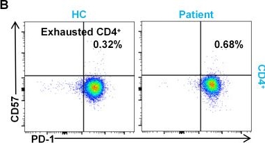 Fig.3.B showing Flow cytometry/Cell sorting in a Homo sapiens (Human) sample from the publication: Thalidomide-mediated immunomodulation in a patient with IL-10RA deficiency-associated very early-onset inflammatory bowel disease.