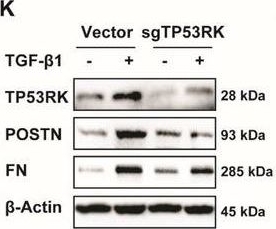 Fig.3.K showing Western Blotting from the publication: TP53RK Drives the Progression of Chronic Kidney Disease by Phosphorylating Birc5.