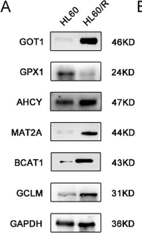 Fig.9.A showing Western Blotting in a Homo sapiens (Human) sample from the publication: Integrative analysis of proteomics and metabolomics reveals amino acid metabolism disorder in adriamycin-resistant acute myeloid leukemia cells.