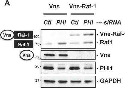 Fig.4.A showing Western Blotting in a Homo sapiens (Human) sample from the publication: PHI-1, an Endogenous Inhibitor Protein for Protein Phosphatase-1 and a Pan-Cancer Marker, Regulates Raf-1 Proteostasis.