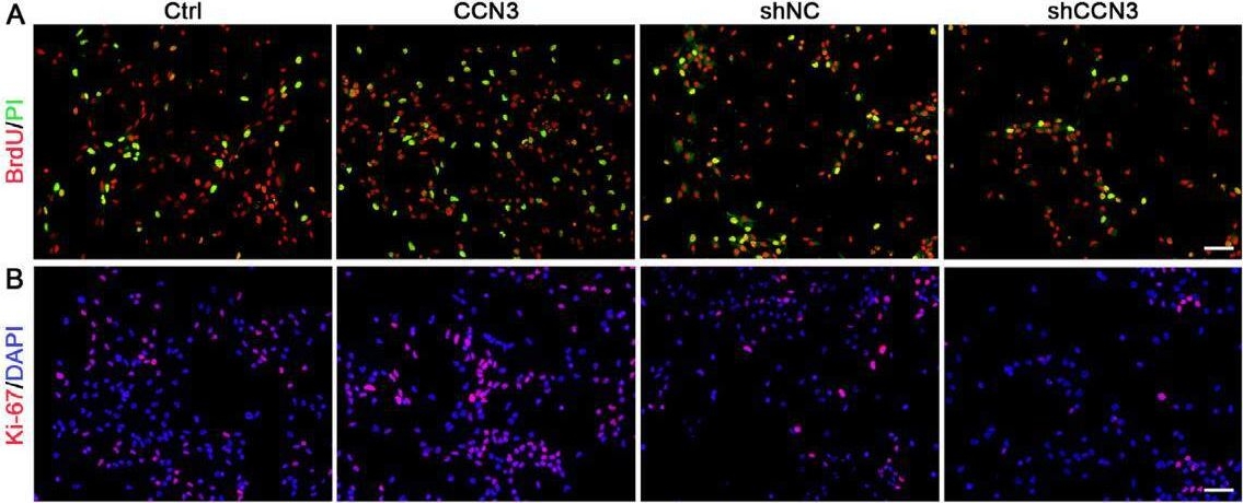 Fig.5.A from the publication: CCN3/NOV Regulates Proliferation and Neuronal Differentiation in Mouse Hippocampal Neural Stem Cells via the Activation of the Notch/PTEN/AKT Pathway.