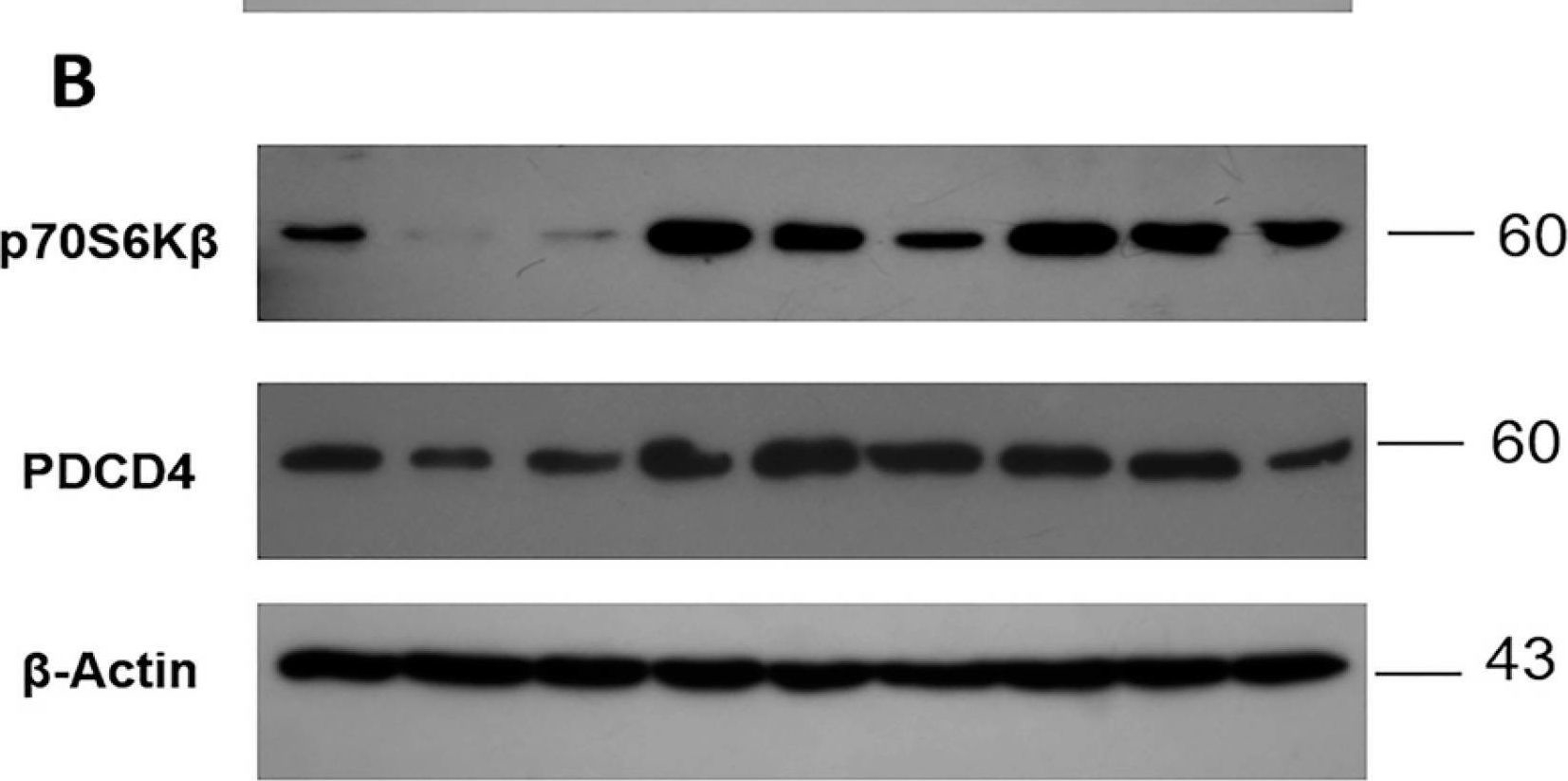 Fig.4.B showing Western Blotting from the publication: Lapatinib-Resistant HER2+ Breast Cancer Cells Are Associated with Dysregulation of MAPK and p70S6K/PDCD4 Pathways and Calcium Management, Influence of Cryptotanshinone.