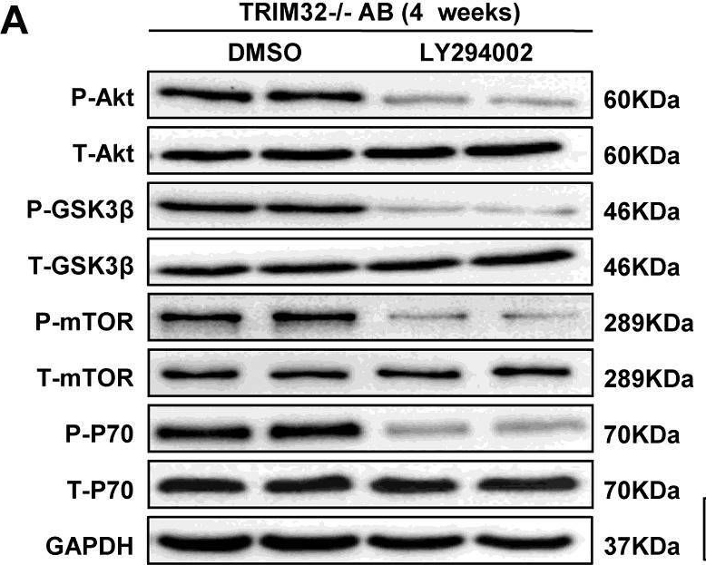Fig.7.A showing Western Blotting from the publication: Tripartite motif 32 prevents pathological cardiac hypertrophy.