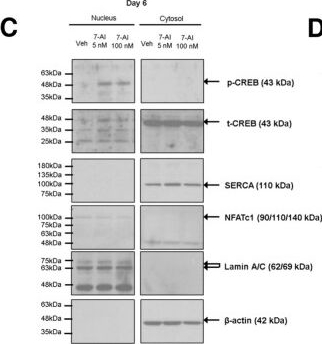 Fig.5.C showing Western Blotting in a Homo sapiens (Human) sample from the publication: Effects of increasing intranuclear calcium levels via MCU inhibition on mouse and human PSC-derived cardiomyocyte differentiation and maturation.