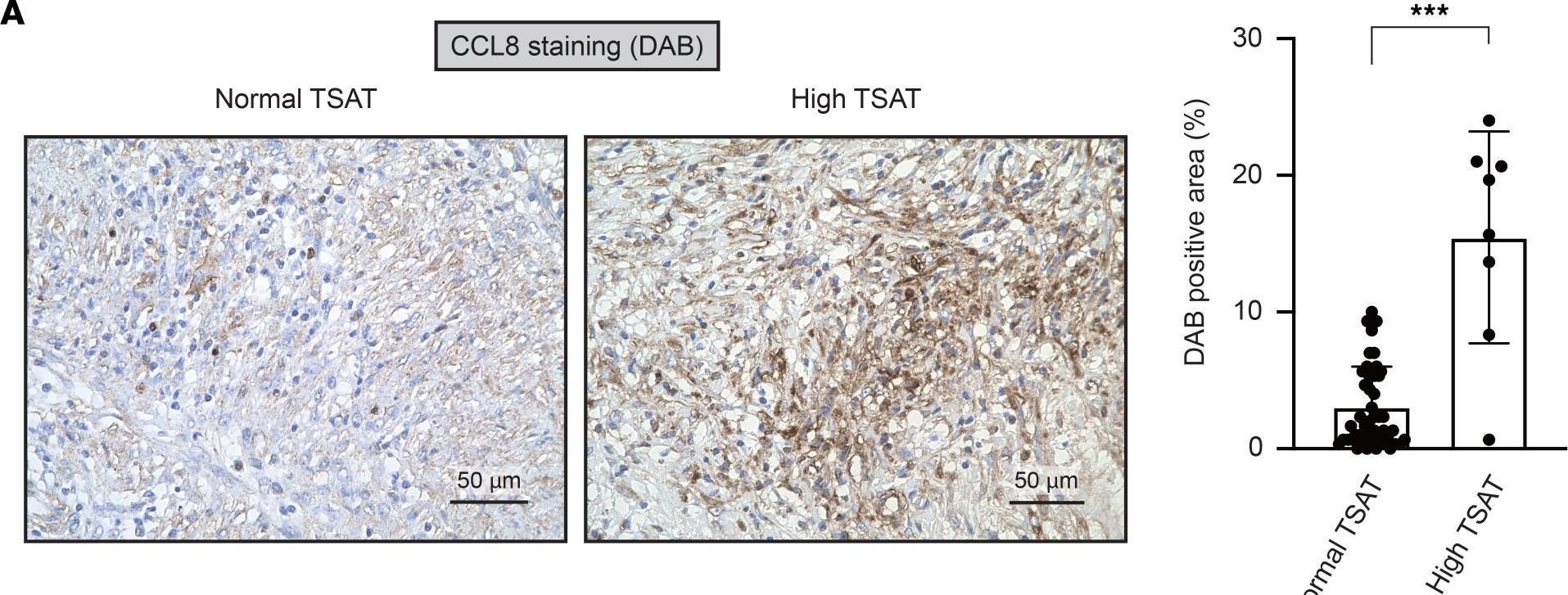 Fig.6.A showing Immunohistochemistry in a Homo sapiens (Human) sample from the publication: Iron accelerates Fusobacterium nucleatum-induced CCL8 expression in macrophages and is associated with colorectal cancer progression.