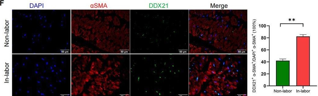 Fig.1.F showing Immunohistochemistry-immunofluorescence from the publication: DExD-Box Helicase 21 Enhances Myometrial Contractions Through Thrombospondin-1-Mediated Increase in Cell Adhesion.