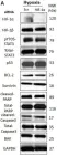 Fig.4.A showing Western Blotting from the publication: STAT3 but Not HIF-1α Is Important in Mediating Hypoxia-Induced Chemoresistance in MDA-MB-231, a Triple Negative Breast Cancer Cell Line.
