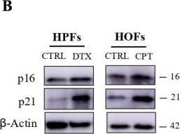 Fig.1.B showing Western Blotting in a Homo sapiens (Human) sample from the publication: Senescent Stroma-Derived Glutamine: A Driver of Aggressiveness in Prostate and Ovarian Cancer Cells.