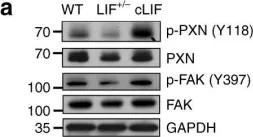 Fig.5.A showing Western Blotting in a Homo sapiens (Human) sample from the publication: Cytoplasmic LIF reprograms invasive mode to enhance NPC dissemination through modulating YAP1-FAK/PXN signaling.