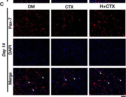 Fig.8.C showing Immunocytochemistry-immunofluorescence in a Mus musculus (House mouse) sample from the publication: Hypobaric Hypoxia Ameliorates Impaired Regeneration After Diabetic Skeletal Muscle Injury by Promoting HIF-1α Signaling.