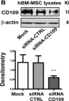 Fig.5.B showing Western Blotting from the publication: CD109 released from human bone marrow mesenchymal stem cells attenuates TGF-β-induced epithelial to mesenchymal transition and stemness of squamous cell carcinoma.