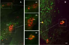 Fig.4.A,B showing Immunocytochemistry-immunofluorescence in a Homo sapiens (Human) sample from the publication: Plasmodium falciparum adhesion on human brain microvascular endothelial cells involves transmigration-like cup formation and induces opening of intercellular junctions.