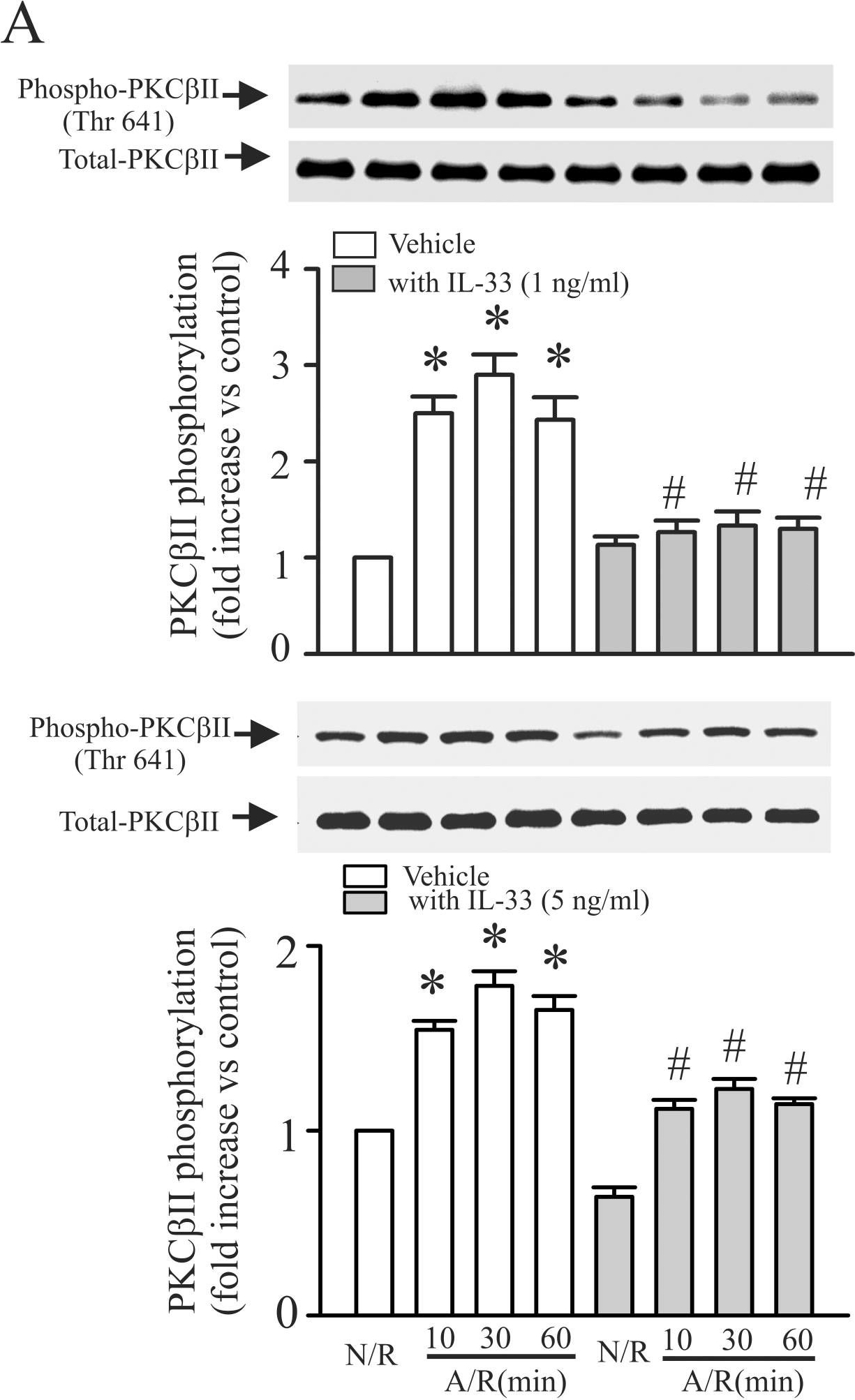 Fig.2.A showing Western Blotting from the publication: IL-33 attenuates anoxia/reoxygenation-induced cardiomyocyte apoptosis by inhibition of PKCβ/JNK pathway.