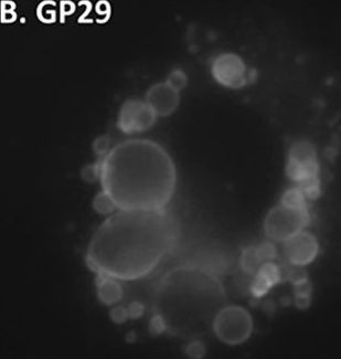 Differential phosphorylation of perilipin 1A at the initiation of lipolysis revealed by novel monoclonal antibodies and high content analysis.