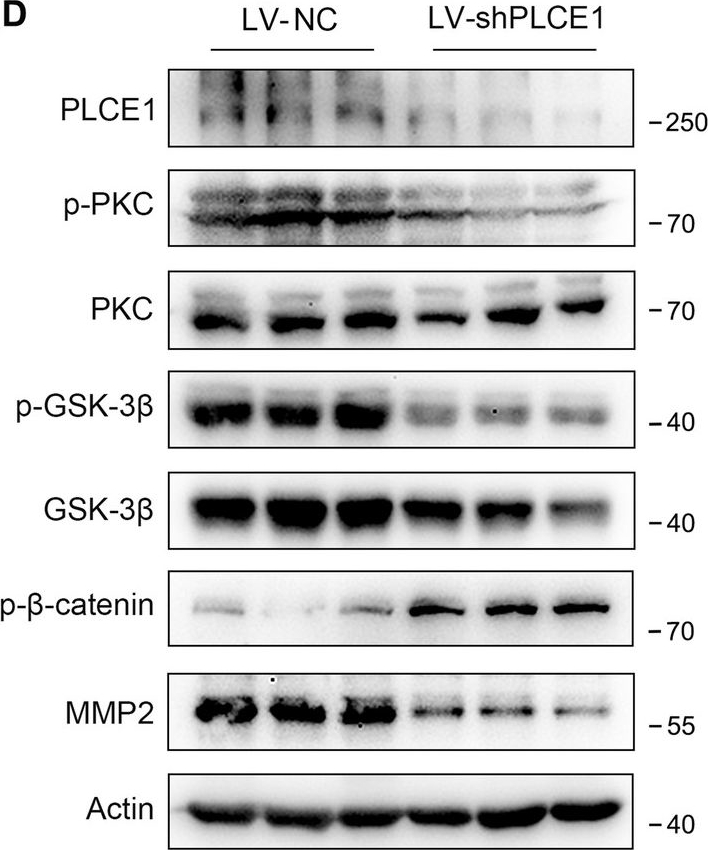 Fig.7.D showing Western Blotting in a Mus musculus (House mouse) sample from the publication: TAK1-mediated phosphorylation of PLCE1 represses PIP2 hydrolysis to impede esophageal squamous cancer metastasis.