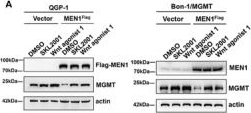 Fig.6.A showing Western Blotting from the publication: MEN1 Deficiency-Driven Activation of the β-Catenin-MGMT Axis Promotes Pancreatic Neuroendocrine Tumor Growth and Confers Temozolomide Resistance.