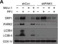 Fig.5.A showing Western Blotting in a Homo sapiens (Human) sample from the publication: Polyphyllin I induces mitophagic and apoptotic cell death in human breast cancer cells by increasing mitochondrial PINK1 levels.