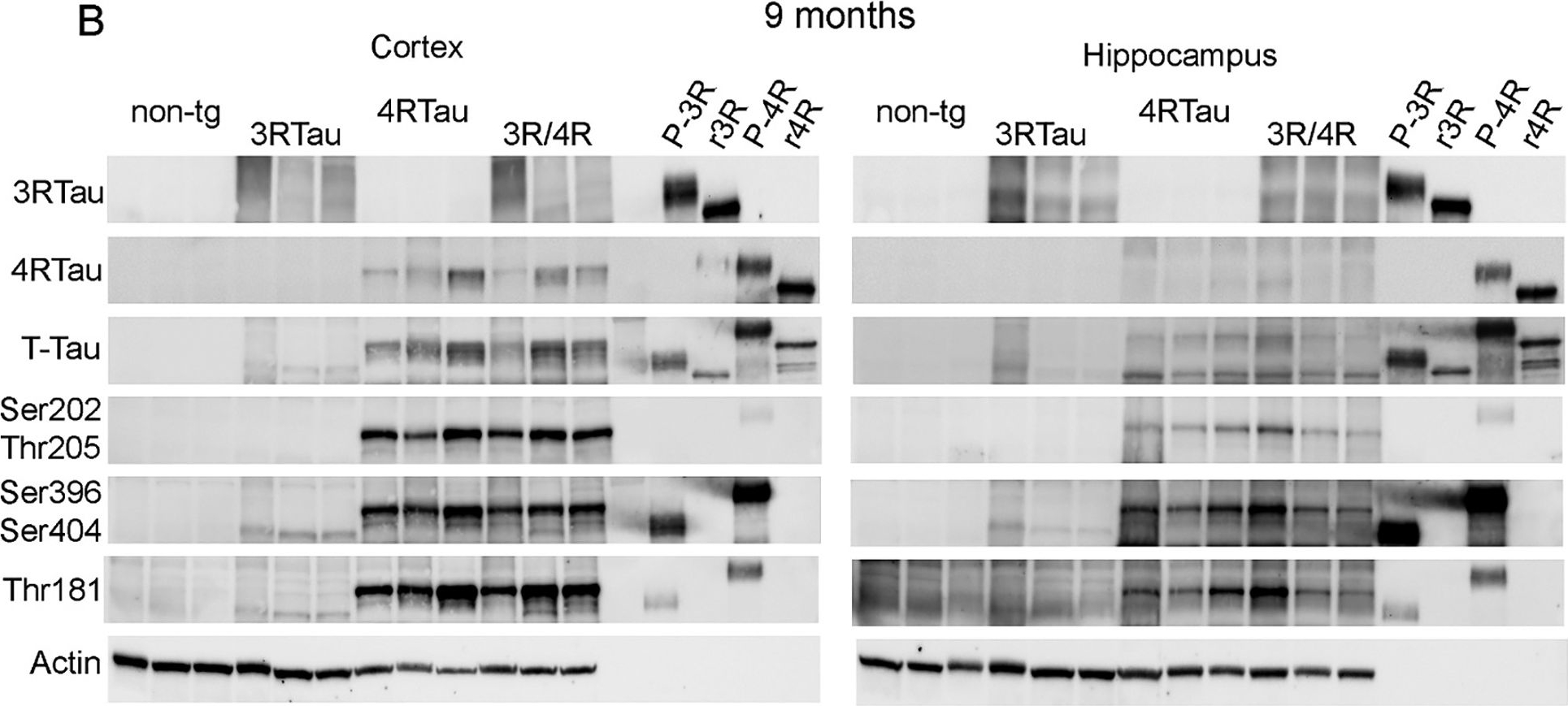 Fig.8.B showing Western Blotting in a Mus musculus (House mouse) sample from the publication: Differential roles of human tau isoforms in the modulation of inflammation and development of neuropathology.