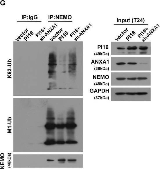 Fig.5.G showing Western Blotting from the publication: Peptidase inhibitor (PI16) impairs bladder cancer metastasis by inhibiting NF-κB activation via disrupting multiple-site ubiquitination of NEMO.
